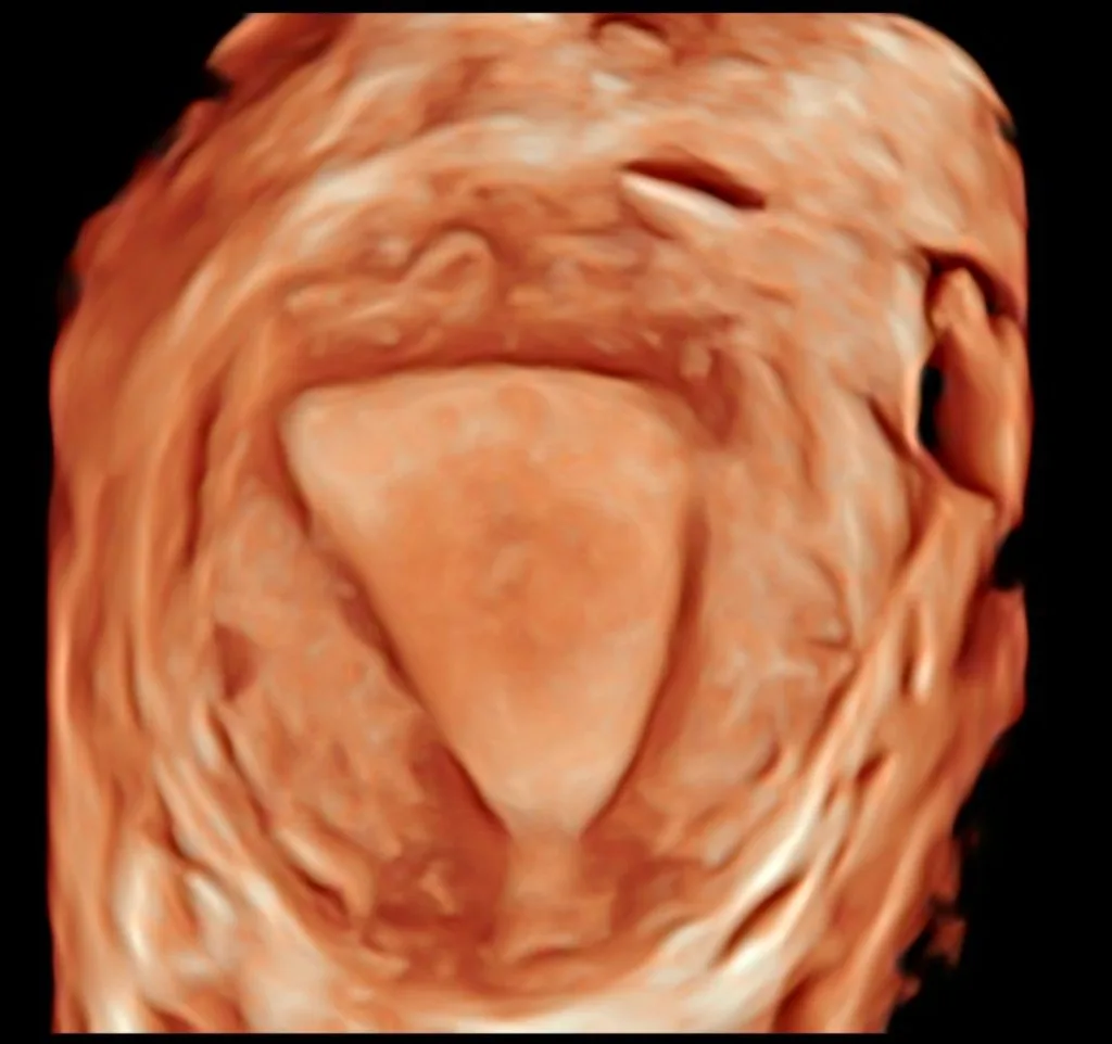 Visualización tridimensional del útero mediante ultrasonido especializado